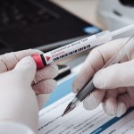 In settimana le linee guida per i test sierologici in Piemonte
